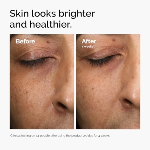 The-Ordinary-Multi-Antioxidant-Radiance-Serum-Vitamin-C-Serum-For-Face-Brighten-Protect-Skin--Boosts-Glow-Shields-Against-Environmental-Stressors-1-Fl-Oz-0-2
